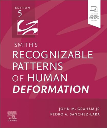 Smith's Recognizable Patterns of Human Deformation book cover